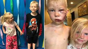 Boy who saved his sister from dog attack speaks to Avenger